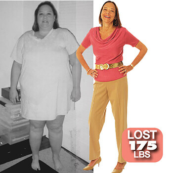Mary Before and After Losing 175 LBS