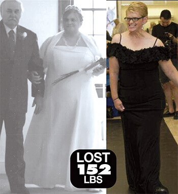 Violet Before and After Losing 152LBS